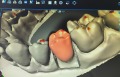 DentalWings a modelace v CAD softwaru